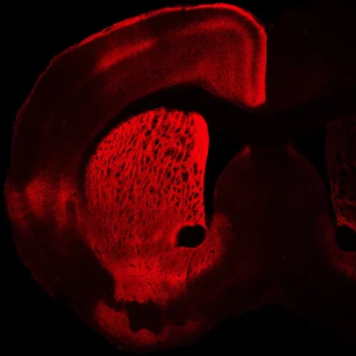Thalamostriatal projections