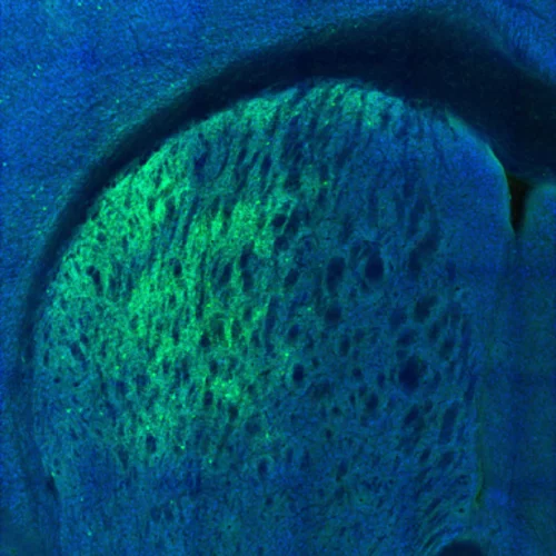 Striatal PV cells